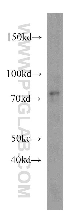 DDX3 Rabbit anti-Human, Mouse, Rat, Polyclonal, Proteintech 150 &mu;L;