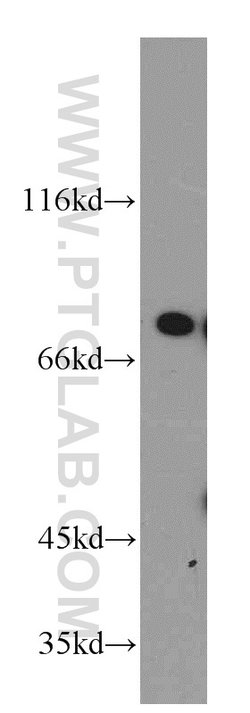 DDX3 Rabbit anti-Human, Mouse, Rat, Polyclonal, Proteintech 150 &mu;L;