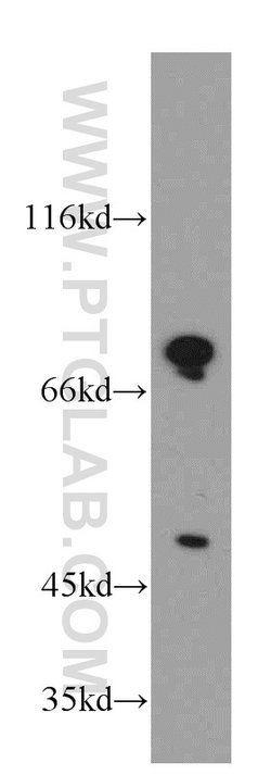 DDX3 Rabbit anti-Human, Mouse, Rat, Polyclonal, Proteintech 150 &mu;L;