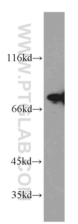 DDX3 Rabbit anti-Human, Mouse, Rat, Polyclonal, Proteintech 150 &mu;L;