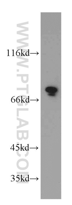 DDX3 Rabbit anti-Human, Mouse, Rat, Polyclonal, Proteintech 150 &mu;L;
