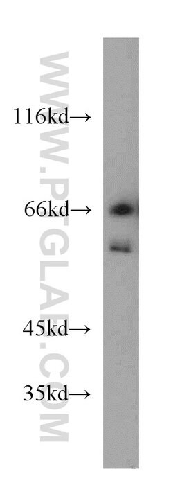 DDX3 Rabbit anti-Human, Mouse, Rat, Polyclonal, Proteintech 150 &mu;L;