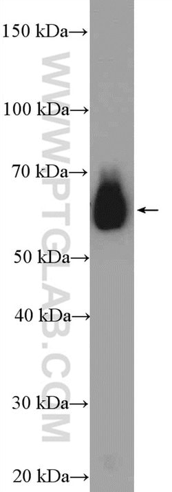 DDX3 Rabbit anti-Human, Mouse, Rat, Polyclonal, Proteintech 150 &mu;L;