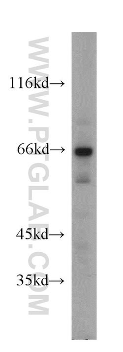 DDX3 Rabbit anti-Human, Mouse, Rat, Polyclonal, Proteintech 150 &mu;L;