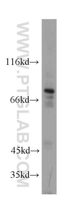 DDX3 Rabbit anti-Human, Mouse, Rat, Polyclonal, Proteintech 150 &mu;L;