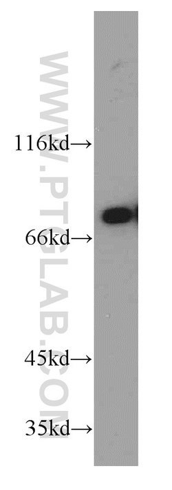 DDX3 Rabbit anti-Human, Mouse, Rat, Polyclonal, Proteintech 150 &mu;L;