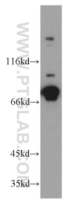 DDX3 Rabbit anti-Human, Mouse, Rat, Polyclonal, Proteintech 150 &mu;L;