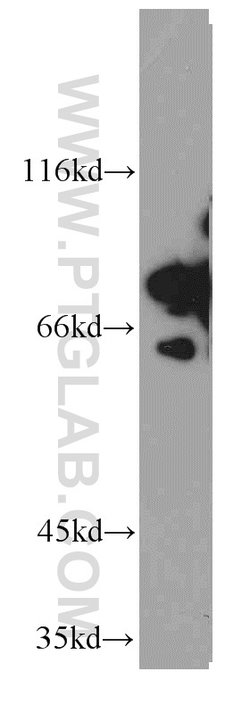 DDX3 Rabbit anti-Human, Mouse, Rat, Polyclonal, Proteintech 150 &mu;L;