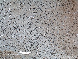 Dysbindin Rabbit anti-Human, Mouse, Rat, Polyclonal, Proteintech 150 &mu;L;