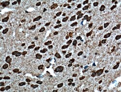 Dysbindin Rabbit anti-Human, Mouse, Rat, Polyclonal, Proteintech 150 &mu;L;