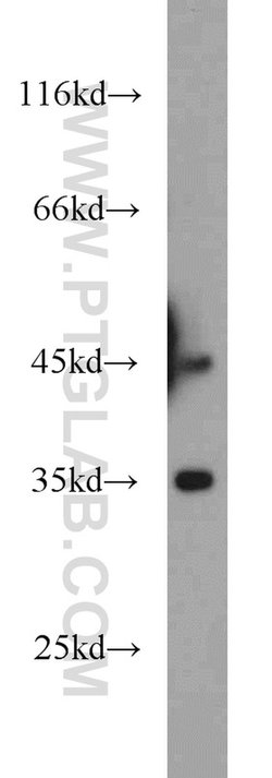 Dysbindin Rabbit anti-Human, Mouse, Rat, Polyclonal, Proteintech 150 &mu;L;