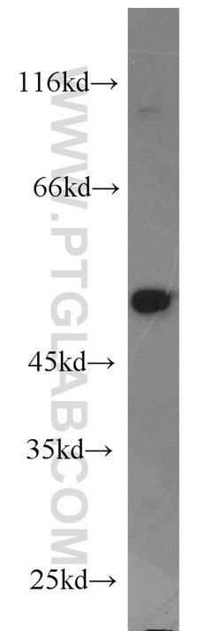 Dysbindin Rabbit anti-Human, Mouse, Rat, Polyclonal, Proteintech 150 &mu;L;