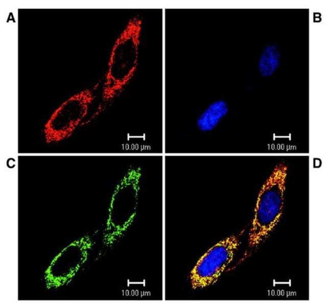 TRAP1 Monoclonal Antibody (Trap16), QED Bioscience 100 μg; UnconjugatedAntibodies, Fisher