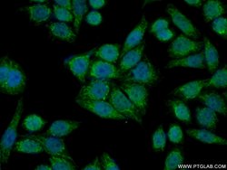 MMAB Rabbit anti-Human, Mouse, Polyclonal, Proteintech:Antibodies:Primary