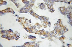 MMAB Rabbit anti-Human, Mouse, Polyclonal, Proteintech:Antibodies:Primary