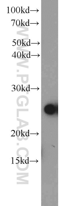 MMAB Rabbit anti-Human, Mouse, Polyclonal, Proteintech:Antibodies:Primary
