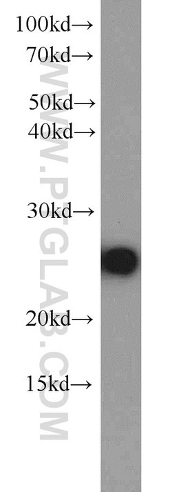 MMAB Rabbit anti-Human, Mouse, Polyclonal, Proteintech:Antibodies:Primary