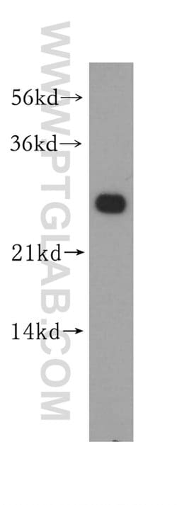 MMAB Rabbit anti-Human, Mouse, Polyclonal, Proteintech:Antibodies:Primary