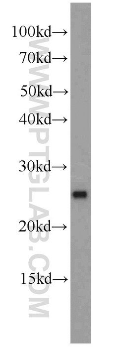 MMAB Rabbit anti-Human, Mouse, Polyclonal, Proteintech:Antibodies:Primary