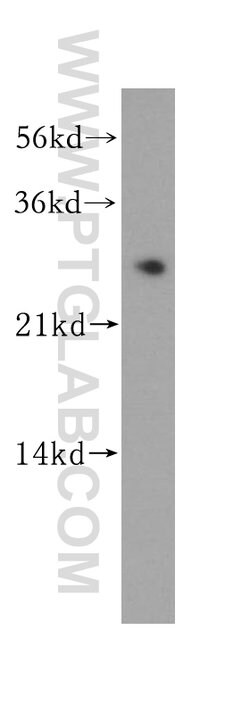 MMAB Rabbit anti-Human, Mouse, Polyclonal, Proteintech:Antibodies:Primary