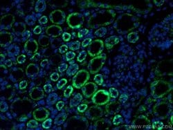 PCCB Rabbit anti-Human, Mouse, Rat, Polyclonal, Proteintech 150 &mu;L;