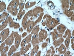 PCCB Rabbit anti-Human, Mouse, Rat, Polyclonal, Proteintech 150 &mu;L;