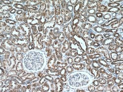 PCCB Rabbit anti-Human, Mouse, Rat, Polyclonal, Proteintech 150 &mu;L;