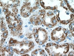 PCCB Rabbit anti-Human, Mouse, Rat, Polyclonal, Proteintech 150 &mu;L;