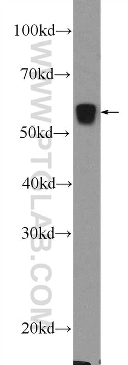 PCCB Rabbit anti-Human, Mouse, Rat, Polyclonal, Proteintech 150 &mu;L;