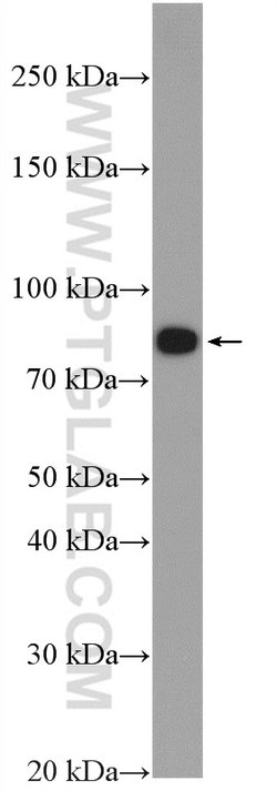 gamma catenin Rabbit anti-Human, Mouse, Rat, Polyclonal, Proteintech 150