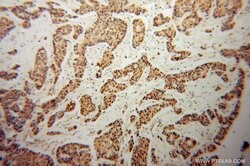 CBP/EIF4E Rabbit anti-Human, Mouse, Rat, Polyclonal, Proteintech:Antibodies:Primary