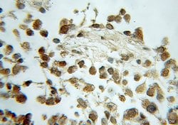 CBP/EIF4E Rabbit anti-Human, Mouse, Rat, Polyclonal, Proteintech:Antibodies:Primary