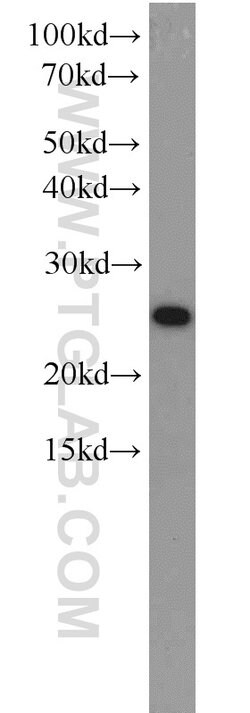 CBP/EIF4E Rabbit anti-Human, Mouse, Rat, Polyclonal, Proteintech:Antibodies:Primary