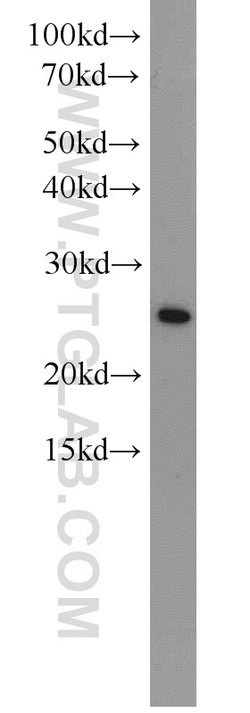 CBP/EIF4E Rabbit anti-Human, Mouse, Rat, Polyclonal, Proteintech:Antibodies:Primary