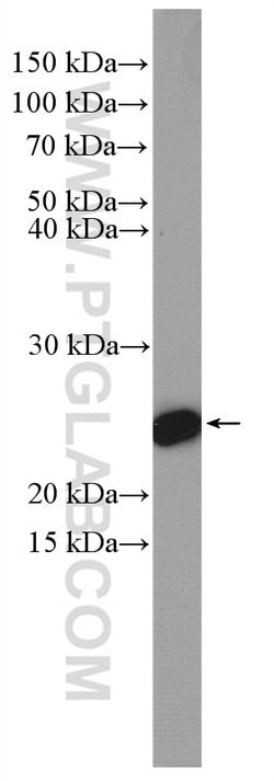 CBP/EIF4E Rabbit anti-Human, Mouse, Rat, Polyclonal, Proteintech:Antibodies:Primary