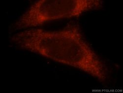 CBP/EIF4E Rabbit anti-Human, Mouse, Rat, Polyclonal, Proteintech:Antibodies:Primary