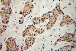 CBP/EIF4E Rabbit anti-Human, Mouse, Rat, Polyclonal, Proteintech:Antibodies:Primary
