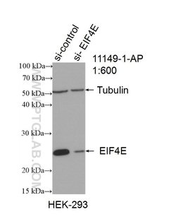 CBP/EIF4E Rabbit anti-Human, Mouse, Rat, Polyclonal, Proteintech:Antibodies:Primary