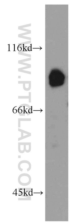 ABCB7 Rabbit anti-Human, Mouse, Rat, Polyclonal, Proteintech 150 &mu;L;