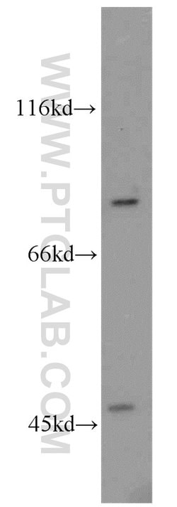 ABCB7 Rabbit anti-Human, Mouse, Rat, Polyclonal, Proteintech 150 &mu;L;