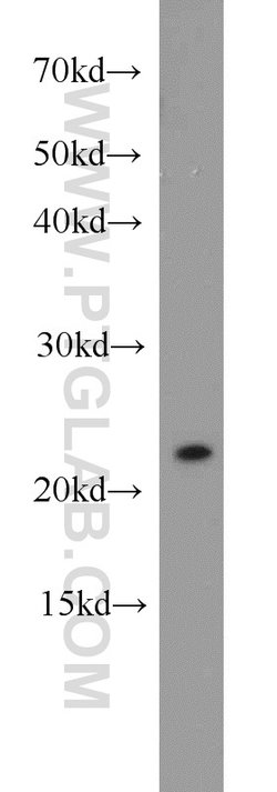 RGS10 Rabbit anti-Human, Mouse, Polyclonal, Proteintech:Antibodies:Primary