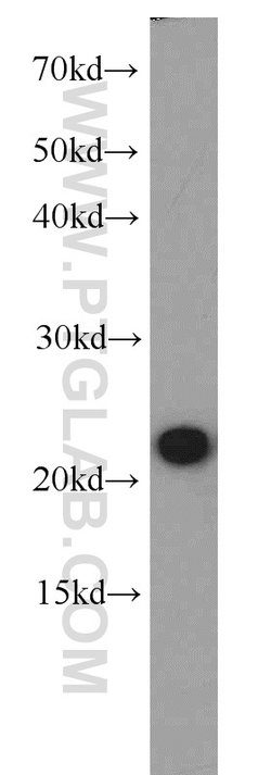 RGS10 Rabbit anti-Human, Mouse, Polyclonal, Proteintech:Antibodies:Primary