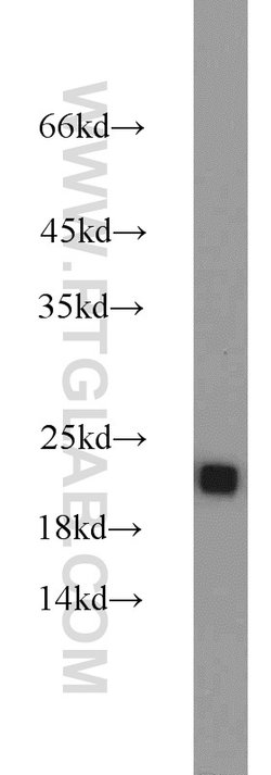 RGS10 Rabbit anti-Human, Mouse, Polyclonal, Proteintech:Antibodies:Primary