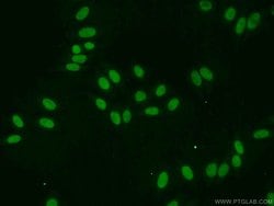 EAF2 Rabbit anti-Human, Mouse, Rat, Polyclonal, Proteintech 150 &mu;L;