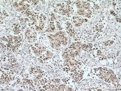 EAF2 Rabbit anti-Human, Mouse, Rat, Polyclonal, Proteintech 150 &mu;L;