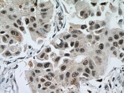 EAF2 Rabbit anti-Human, Mouse, Rat, Polyclonal, Proteintech 150 &mu;L;