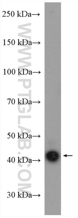 EAF2 Rabbit anti-Human, Mouse, Rat, Polyclonal, Proteintech 150 &mu;L;