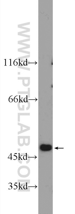 EAF2 Rabbit anti-Human, Mouse, Rat, Polyclonal, Proteintech 150 &mu;L;
