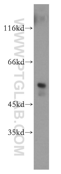 FKBP8 Rabbit anti-Human, Mouse, Polyclonal, Proteintech 20 &mu;L; Unconjugated 