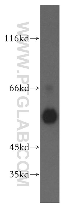 FKBP8 Rabbit anti-Human, Mouse, Polyclonal, Proteintech 20 &mu;L; Unconjugated 